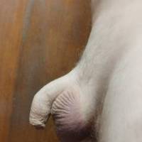 Shrivelled tiny dick
