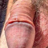 dick