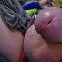 dick