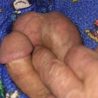 Dick pic