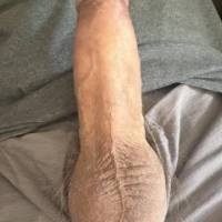 Dick