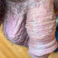 dick