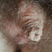 My hairy tiny dick and foreskin,small testikles