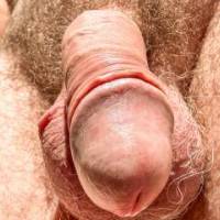 dick