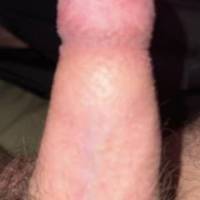 Dick