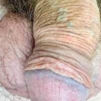 dick