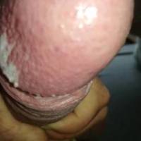 Dick head