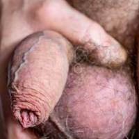 dick