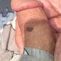 Dick pic