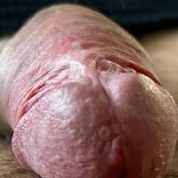 Dick
