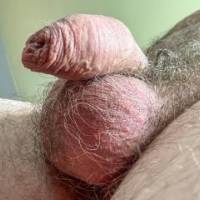 dick