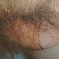 A close up of my small dick that is barely seen by my hair... December of 2024. A Panasonic T3 camera was used.