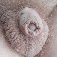 My erectile dysfunction dickie
Not shaved