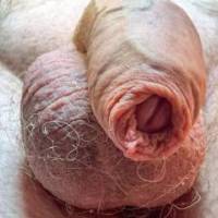 dick