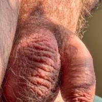 dick