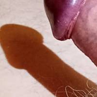 Dick out in the sunshine