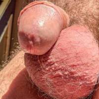 dick