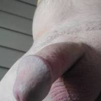 Dick