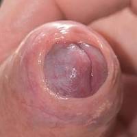 Dick pic
