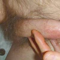 My dick has become hard after the rubbing of tong balm on my dick with my fingers... December of 2024. A Panasonic T3 camera was used.