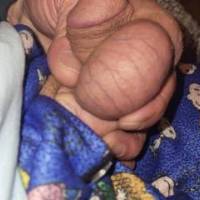 Dick pic