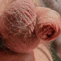 dick
