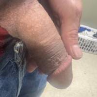 Showing Limp Dick