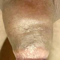 Pumped my dick last night it looks shorter, but man is it nice and thick. A lot of discoloration.