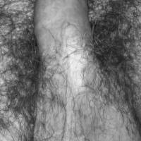 dick