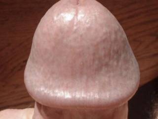 What do you think of Mr. Florida man’s head?  From Mrs. Floridaman