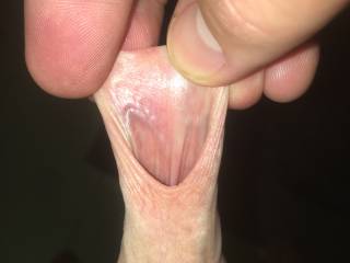 stretching my foreskin out so you can see the inside side.
