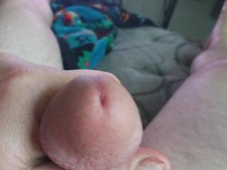 Who wants to squeeze my head?