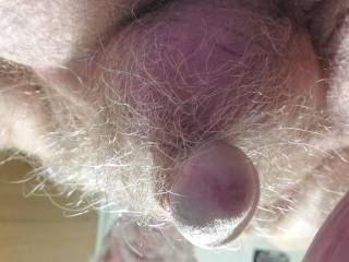 A hairy set of balls