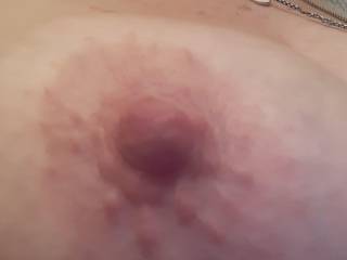 Puffy nipple