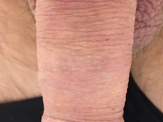 Is it suck able??