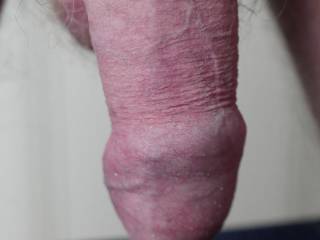 Hope you like some skin