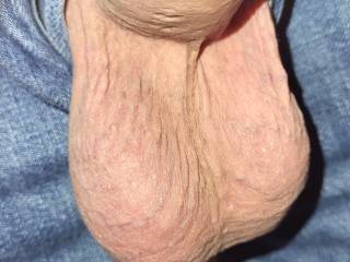 My saggy balls