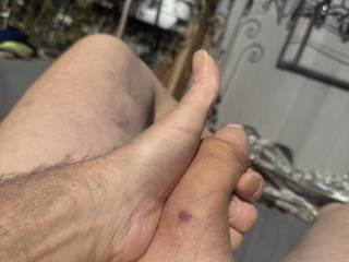 Enjoying the spring warmth, found a boo-boo, would anybody kiss it better for me?