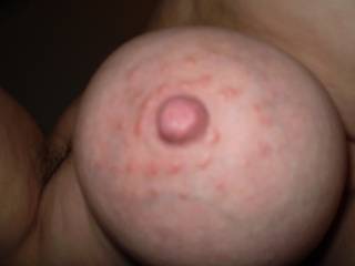 do you big bumpy nipples