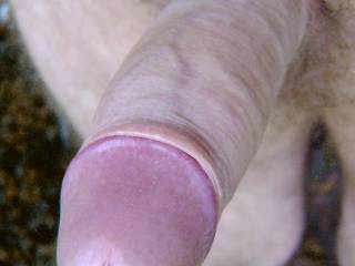 Erect penis