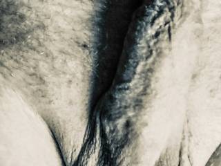 Penis