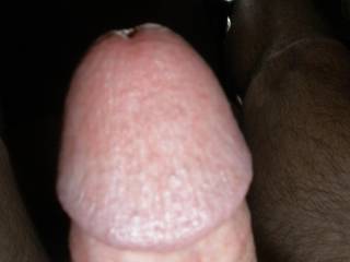 a close-up of my knob