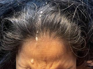 Released on a Thai face