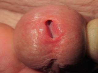 My Peehole