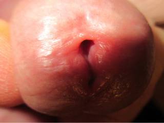 My Peehole