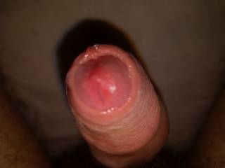 My head
