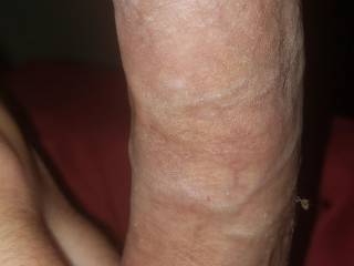 Hard