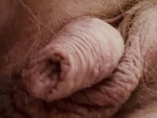 Foreskin 4 U