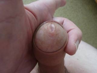 part covered glans,having to hold my foreskin forward