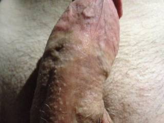 Wrinkle Dinkle